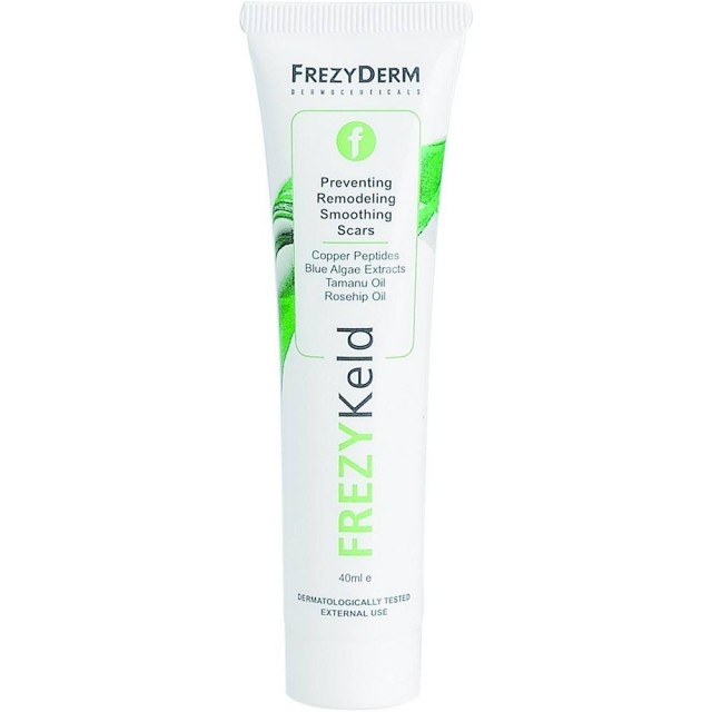 FREZYDERM FREZYKELD ΚΡΕΜΑ ΓΙΑ ΠΡΟΛΗΨΗ ΚΑΙ ΒΕΛΤΙΩΣΗ ΟΥΛΩΝ 40ML